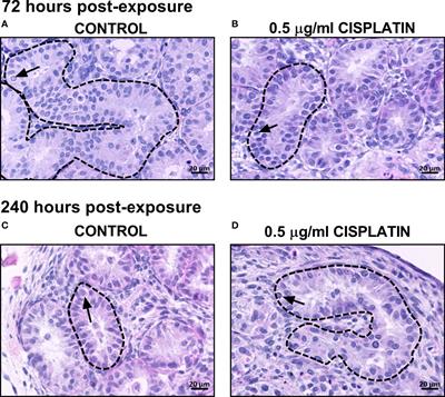 Cisplatin Effects on the Human Fetal Testis – Establishing the Sensitive Period for (Pre)Spermatogonial Loss and Relevance for Fertility Preservation in Pre-Pubertal Boys